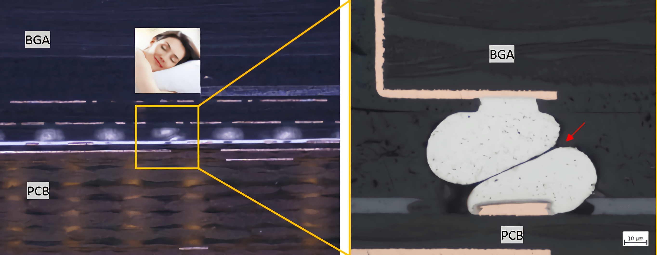 Understanding the Welding Failure in Ball Grid Array (BGA) HeadinPillow IMI